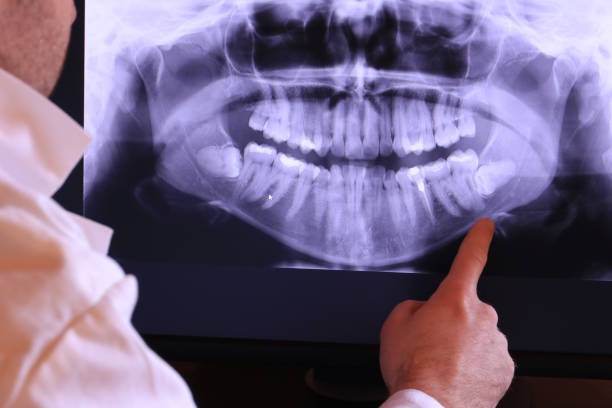 Best Emergency Dentist for Knocked-Out Tooth in Trophy Clu, TX